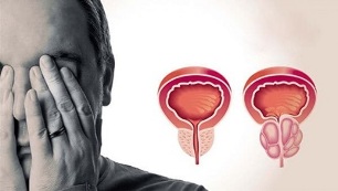 příčiny prostatitidy u mužů